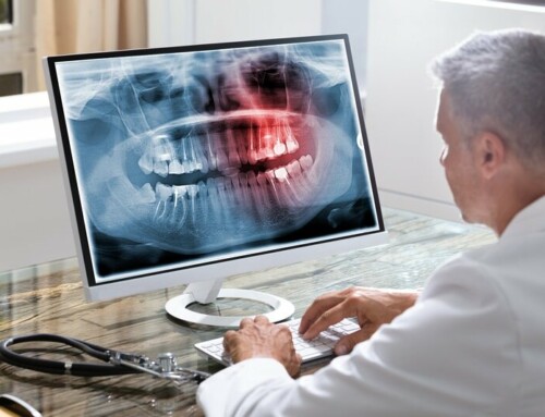 Wij bieden uitgebreide ICT ondersteuning voor tandartspraktijken, zodat u erop kunt vertrouwen dat uw apparatuur altijd probleemloos werkt